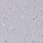 Silvercloud FS 122 - Płyty mineralno-akrylowe Staron